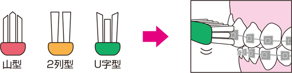 矯正用歯ブラシ