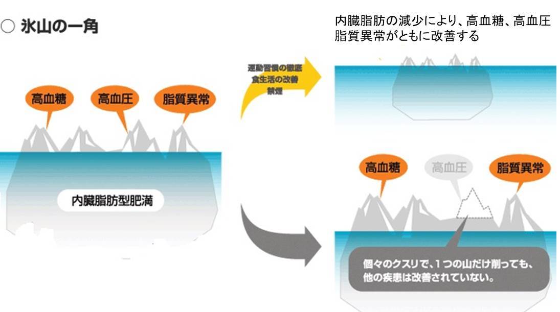メタボリックシンドローム